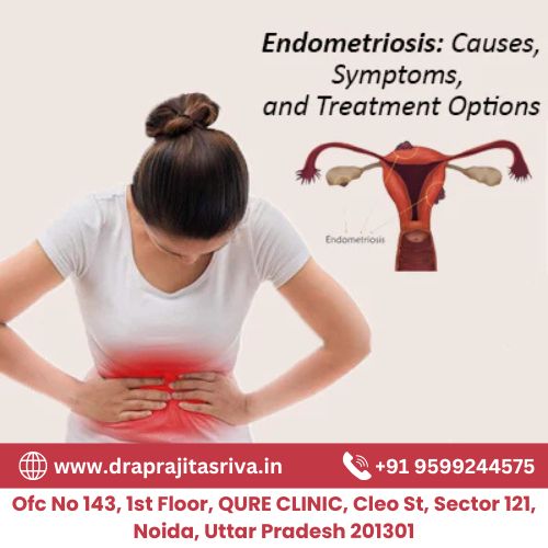 Understanding Endometriosis