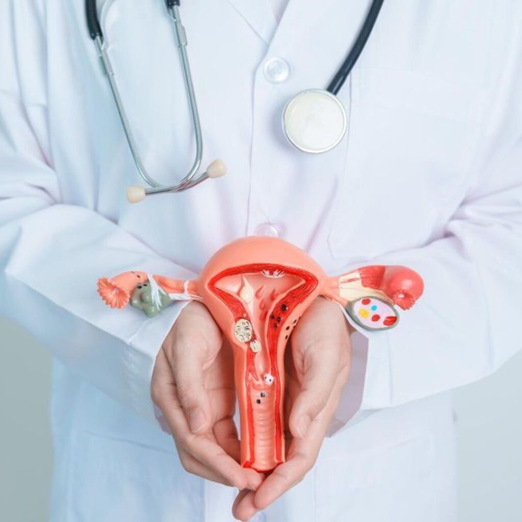 IVF for Endometriosis Patients: What You Should Know