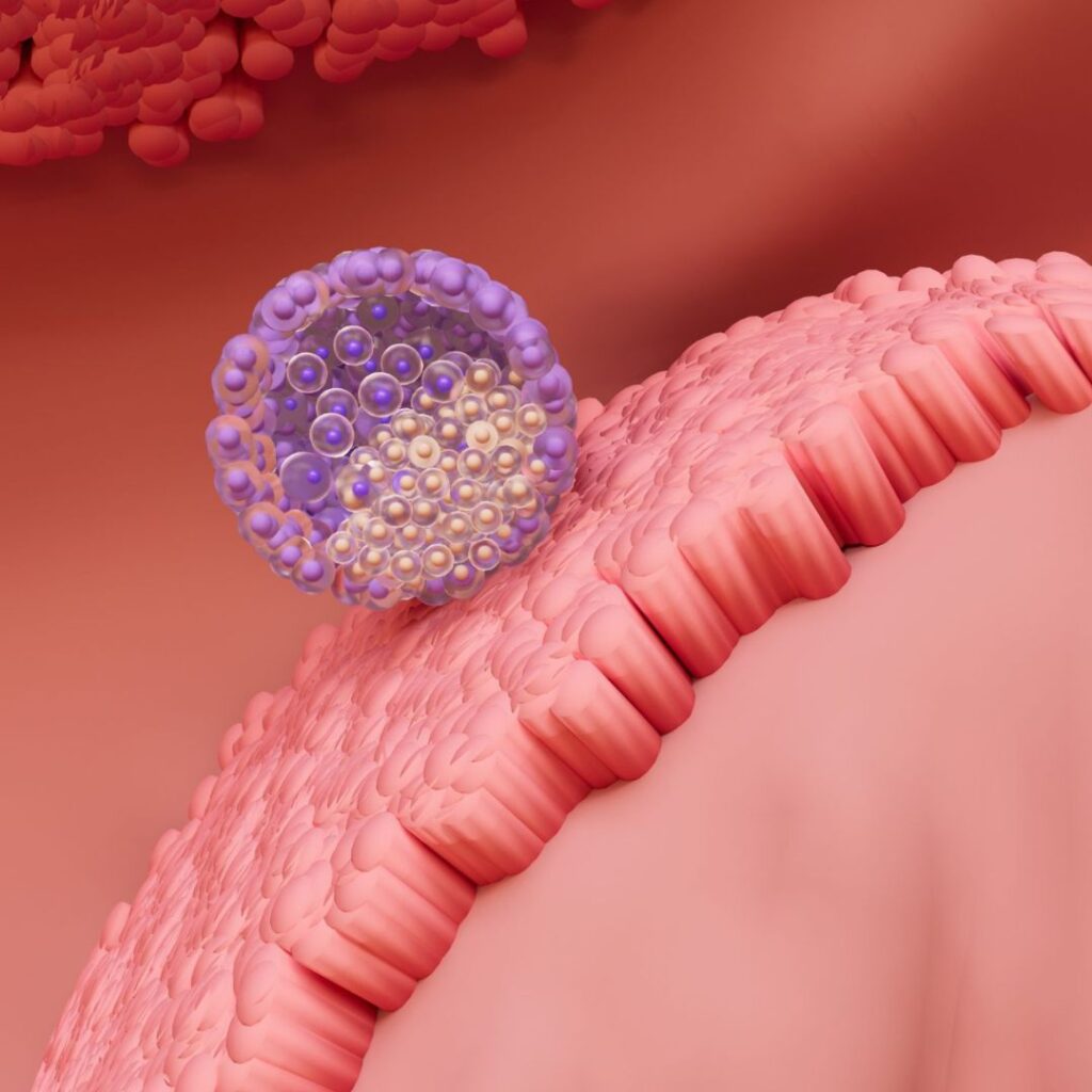 Understanding Implantation During IVF