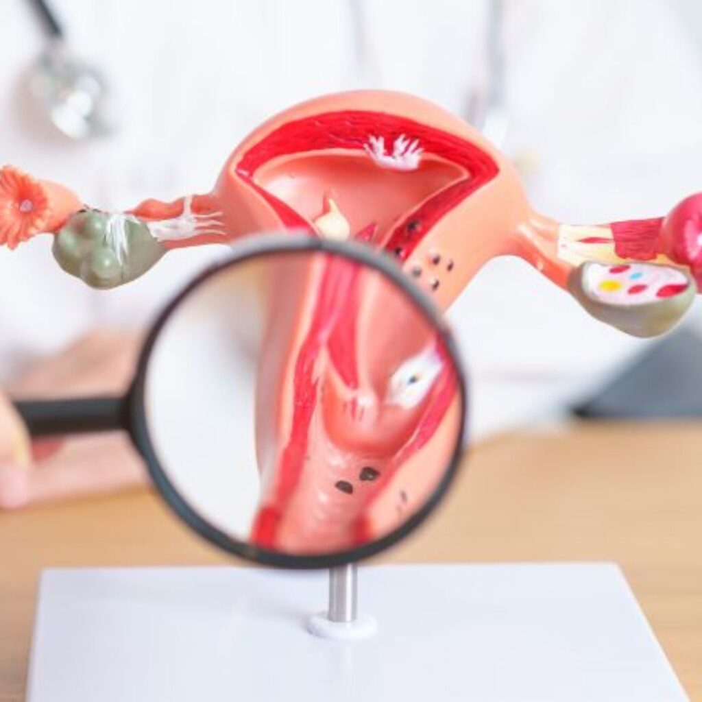 A Complete Guide to Cervical Cancer Prevention and Early Detection