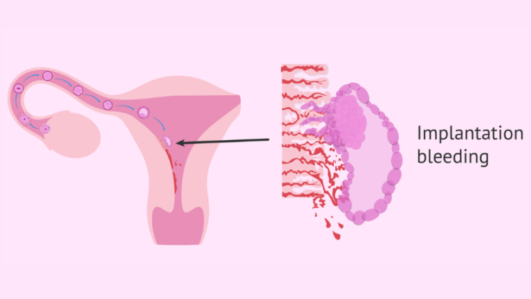 9 Myths and Facts After Blastocyst Transfer