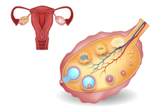 Antral Follicle Count