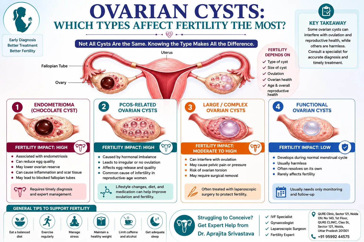 Which Types of Ovarian Cysts Affect Fertility the Most?