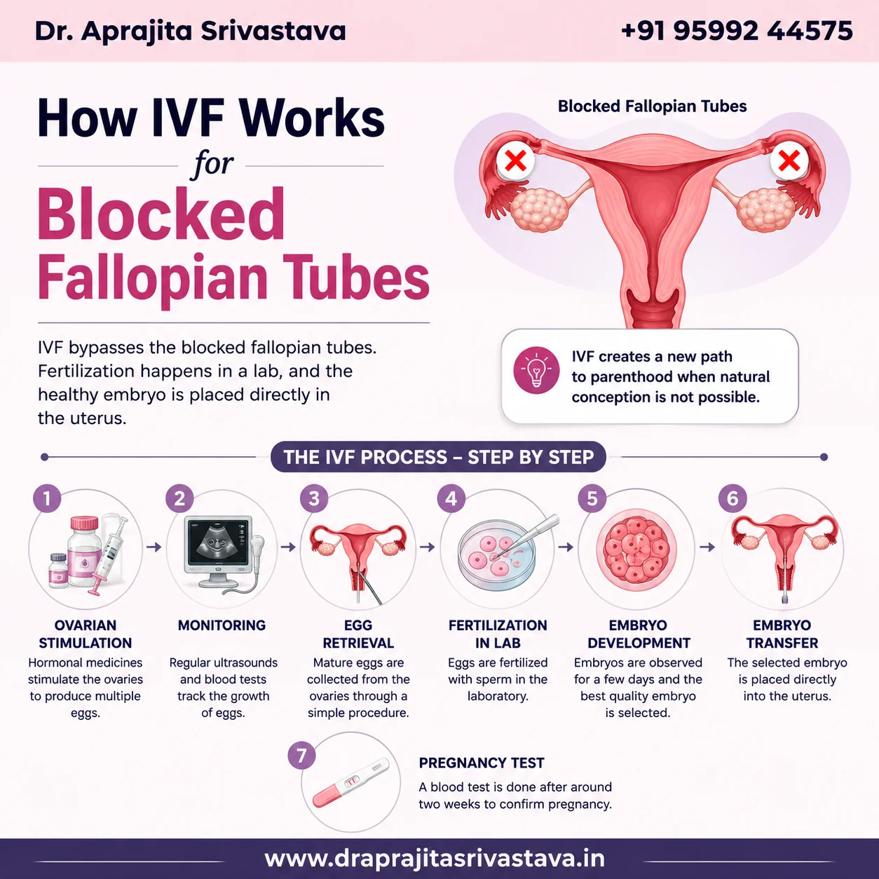 IVF for blocked fallopian tubes
